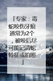 专家：毒蛇咬伤牙痕通常为2个，被咬后尽可能记清蛇特征或拍照